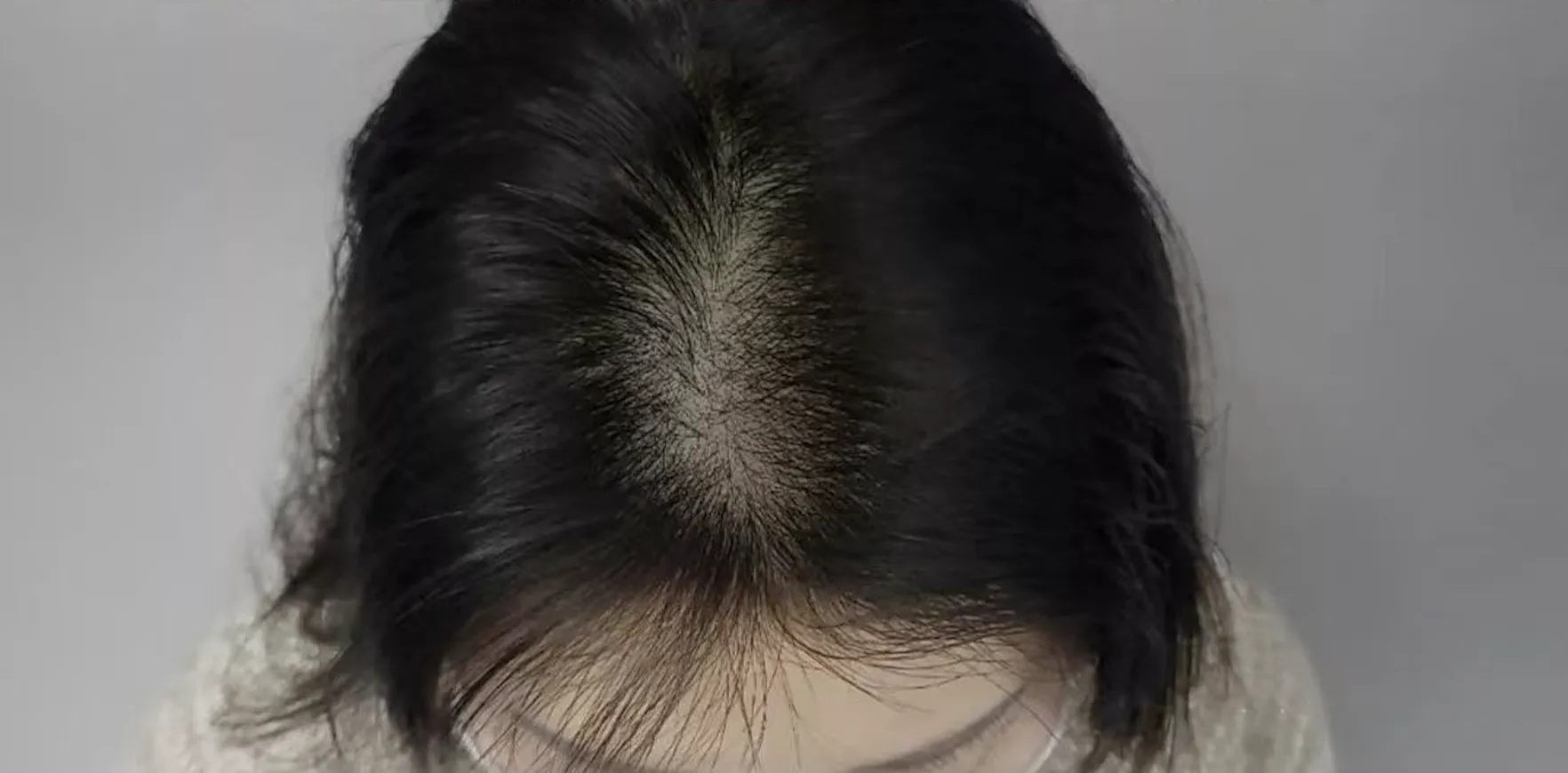 頭頂加密