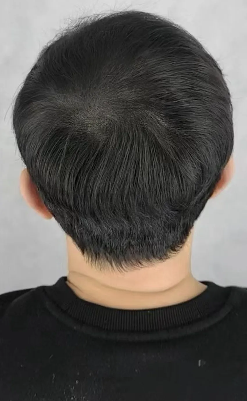 後腦勺