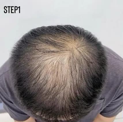 實際客戶案例 STEP1