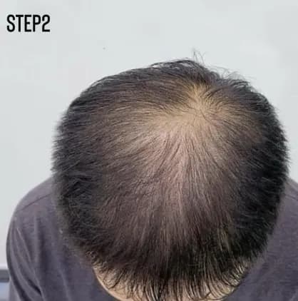 實際客戶案例 STEP2