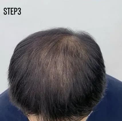 實際客戶案例 STEP3