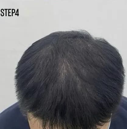 實際客戶案例 STEP4