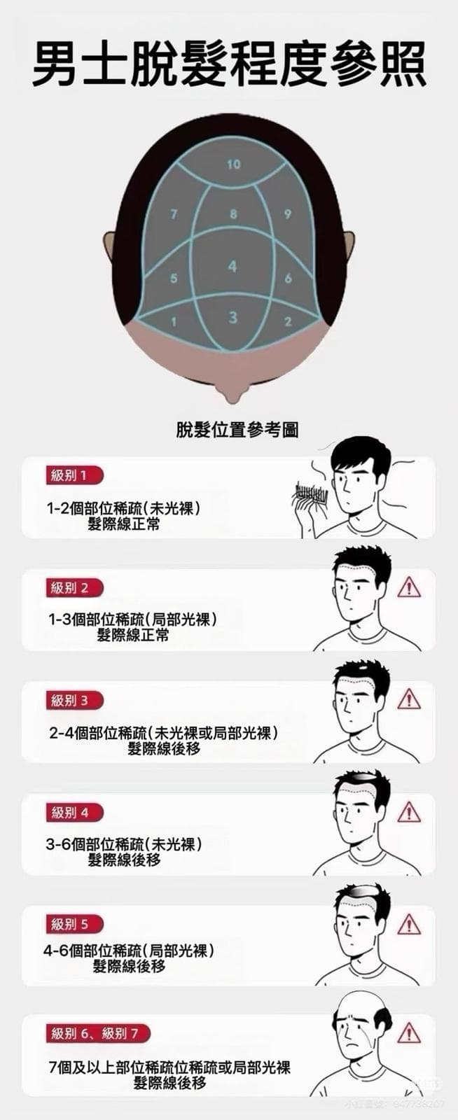 男士脫髮程度參照